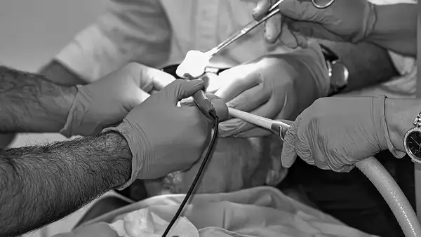 Biopsja mammotomiczna – cena, ból i opinie pacjentek