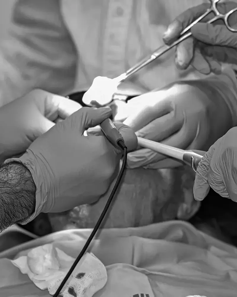 Biopsja mammotomiczna – cena, ból i opinie pacjentek