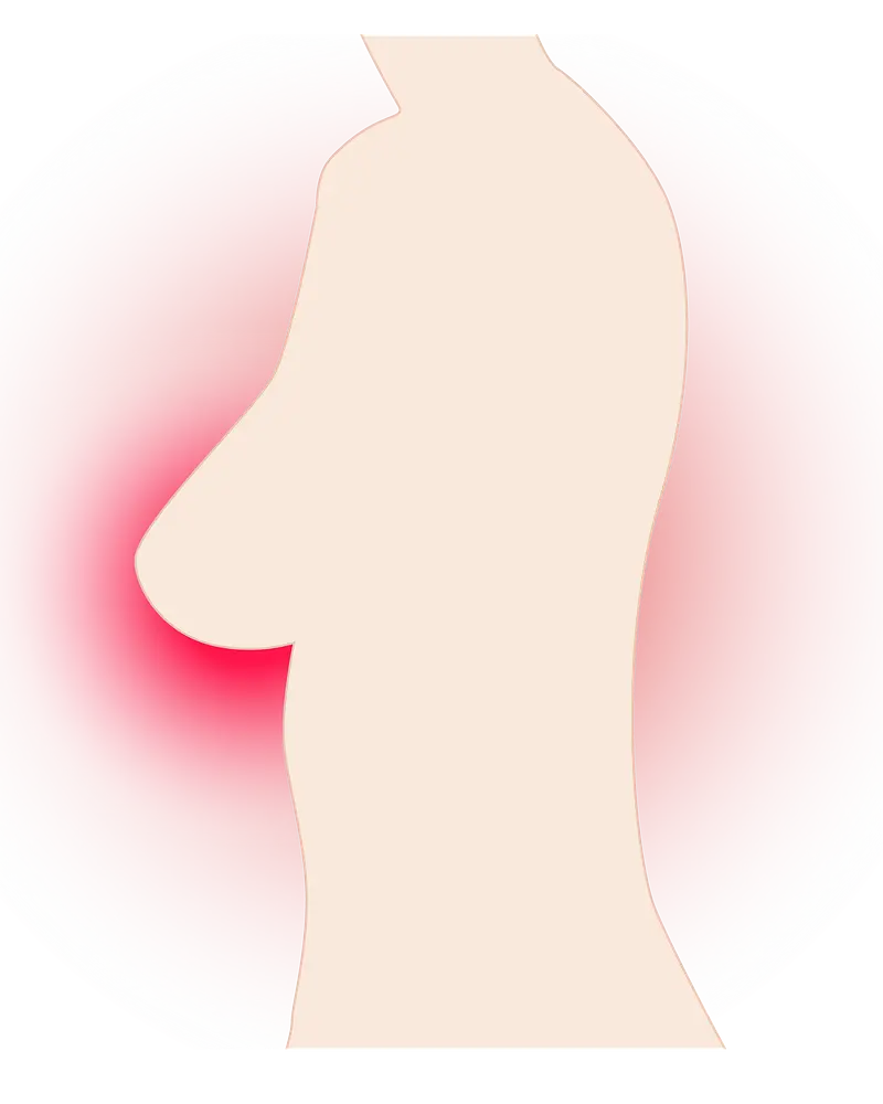 Pielęgnacja po biopsji mammotomicznej – praktyczne porady